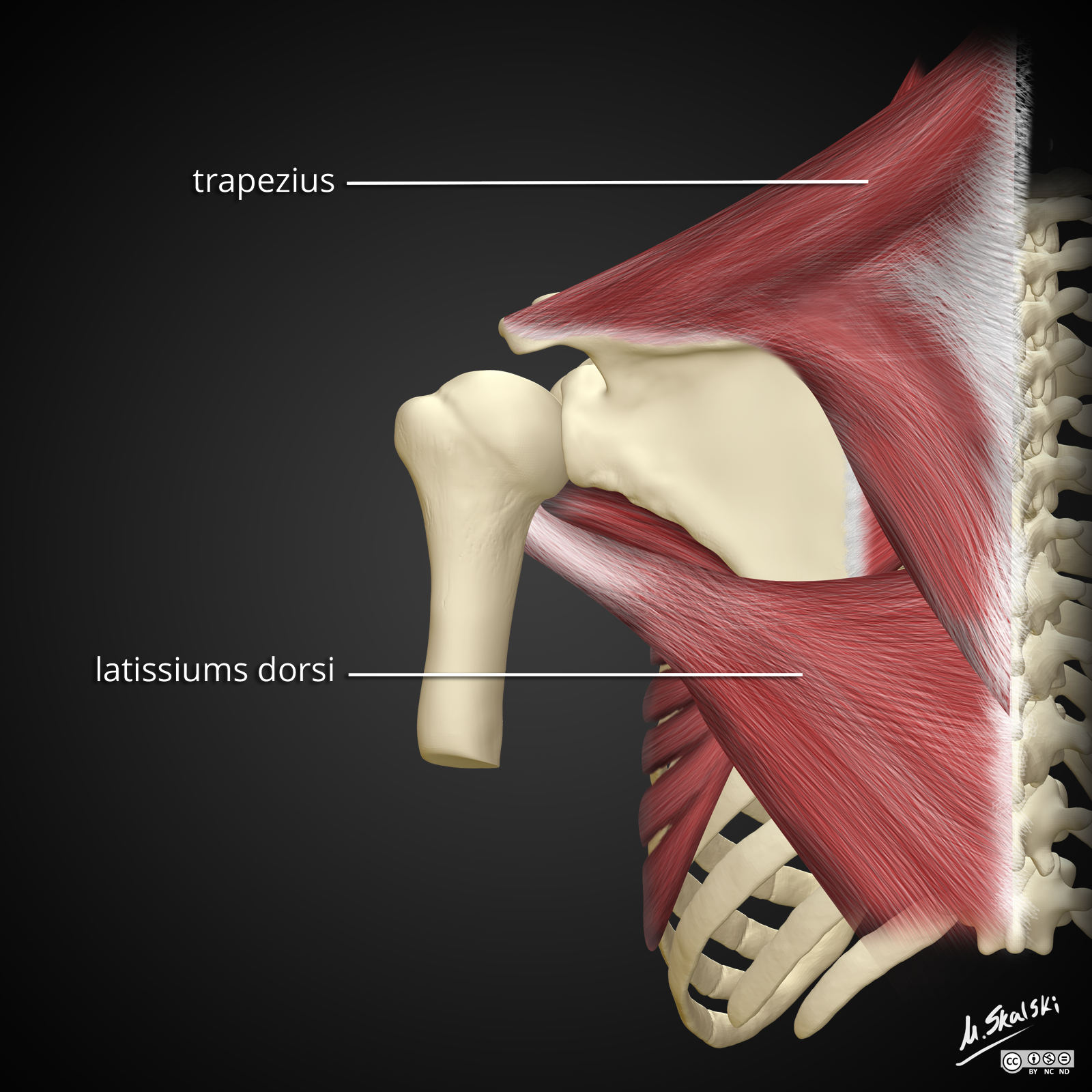 Radiopaedia Drawing Trapezius and latissimus dorsi muscles English